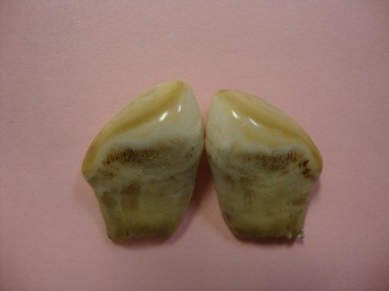 resize teeth.jpg