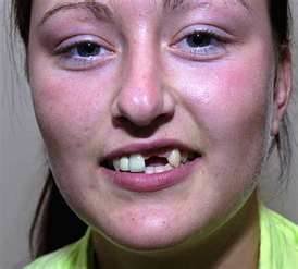 toothless1.jpg toothless1.jpg