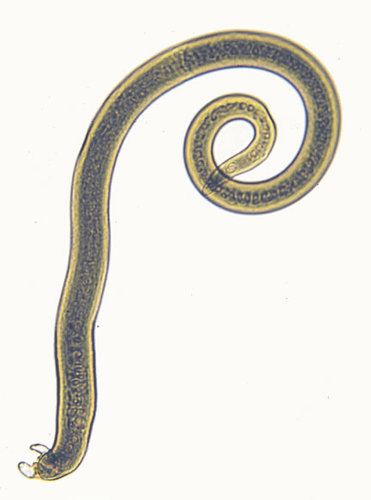 trichinella.jpg