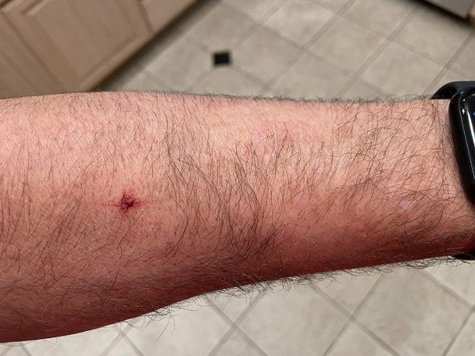 arm.jpg