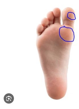Foot.JPG Foot.JPG