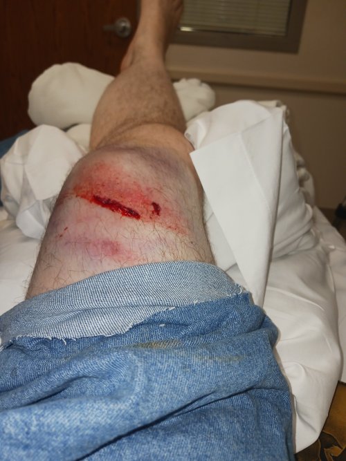 20240303_181203.jpg 20240303_181203.jpg