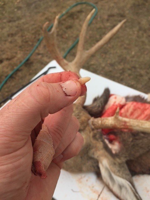 tooth.jpg