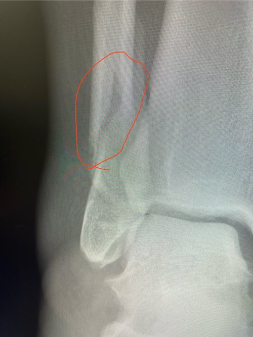 IMG_5912.jpeg IMG_5912.jpeg