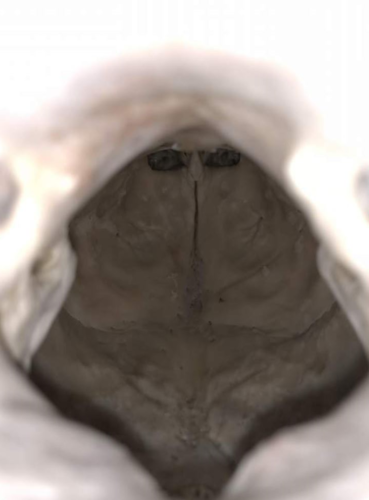 skull.png skull.png