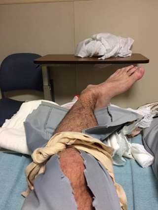 ankle.jpg