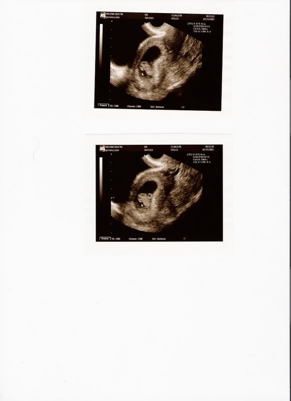 babygroven_8wks.jpg