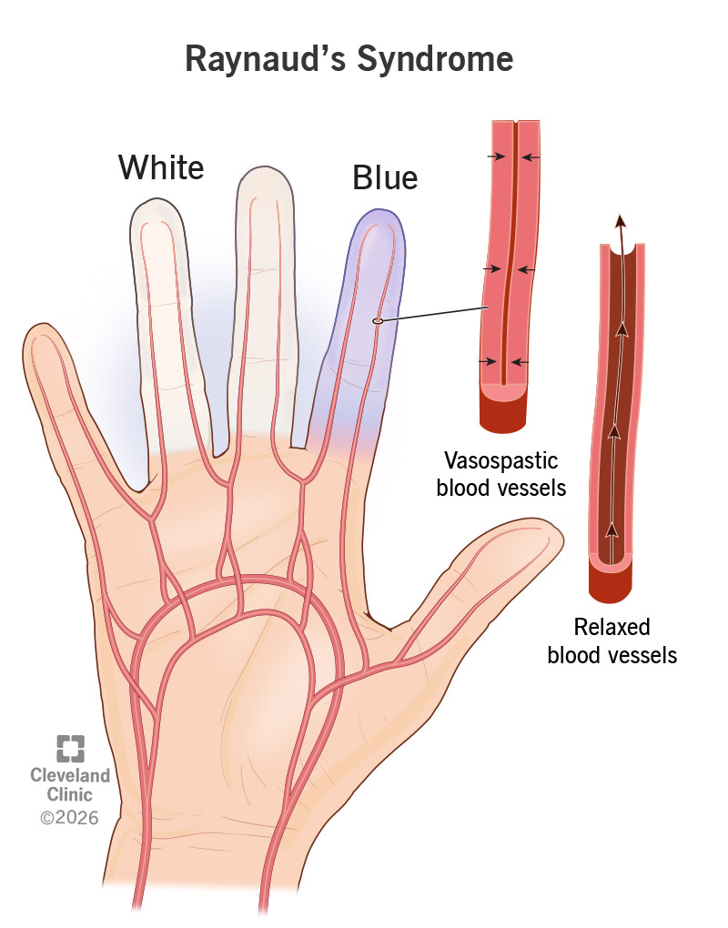 my.clevelandclinic.org