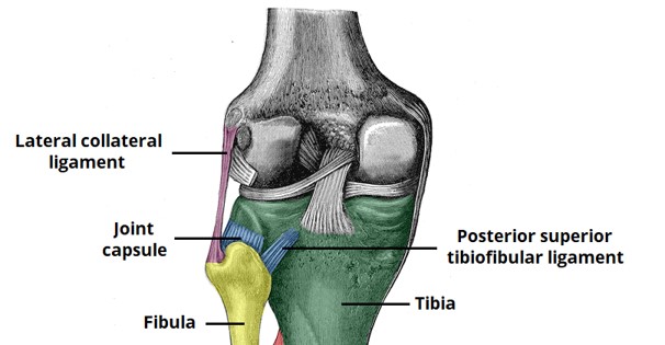 fib-head-pain.jpg